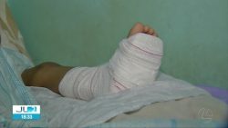 crianca-atropelada-no-dia-das-maes-apos-voltar-da-igreja-em-belem-sente-muitas-dores-no-corpo,-afirma-familia